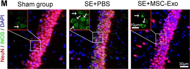 Mouse IgG (H+L) Highly Cross-Adsorbed Secondary Antibody in Immunohistochemistry (IHC)