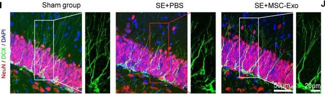 Mouse IgG (H+L) Highly Cross-Adsorbed Secondary Antibody in Immunohistochemistry (IHC)