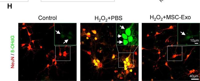 Goat IgG (H+L) Cross-Adsorbed Secondary Antibody in Immunohistochemistry (IHC)