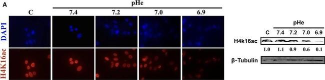 Mouse IgG (H+L) Secondary Antibody in Western Blot (WB)