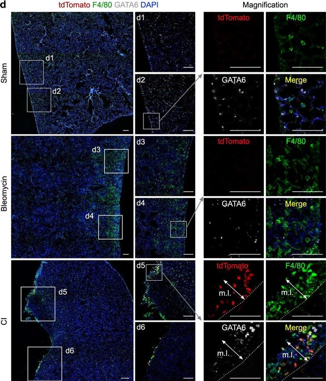 Goat IgG (H+L) Cross-Adsorbed Secondary Antibody in Immunohistochemistry (IHC)