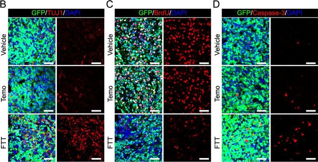 Goat IgG (H+L) Cross-Adsorbed Secondary Antibody in Immunohistochemistry (IHC)