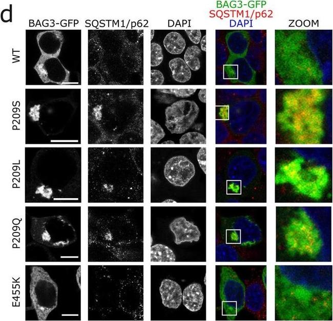 Mouse IgG (H+L) Highly Cross-Adsorbed Secondary Antibody in Immunohistochemistry (IHC)