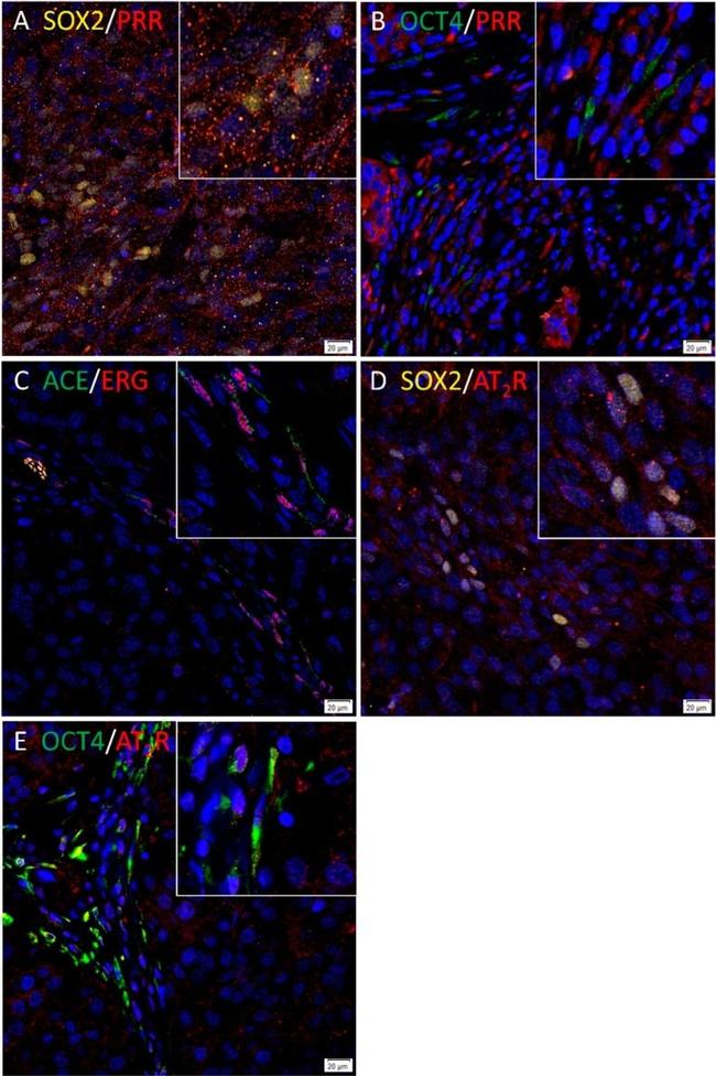 Rabbit IgG (H+L) Highly Cross-Adsorbed Secondary Antibody in Immunocytochemistry (ICC/IF)