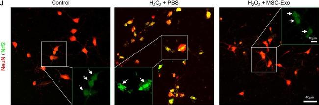 Rabbit IgG (H+L) Highly Cross-Adsorbed Secondary Antibody in Immunohistochemistry (IHC)