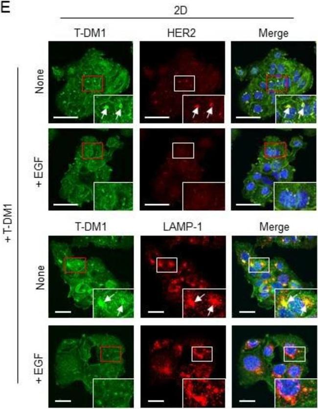 Mouse IgG (H+L) Highly Cross-Adsorbed Secondary Antibody in Immunocytochemistry (ICC/IF)