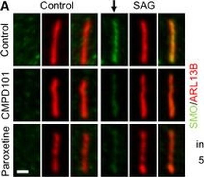 Rabbit IgG (H+L) Highly Cross-Adsorbed Secondary Antibody in Immunohistochemistry (IHC)