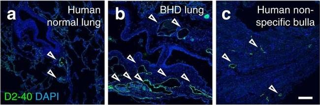 Goat IgG (H+L) Cross-Adsorbed Secondary Antibody in Immunohistochemistry (IHC)