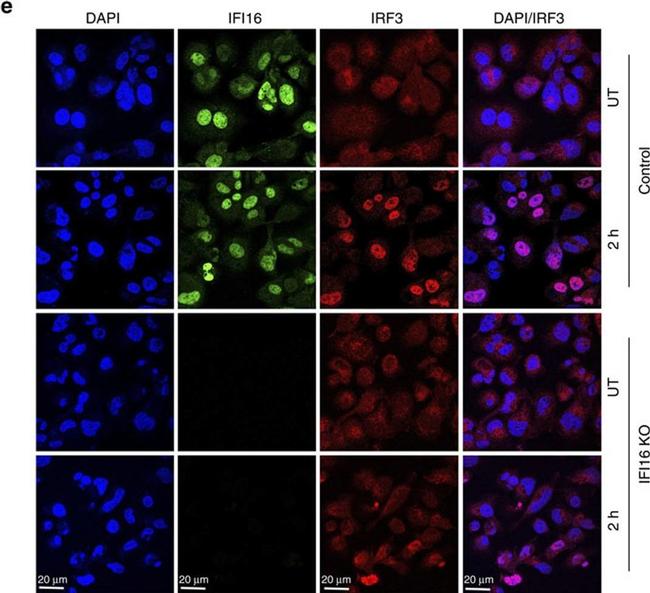 Goat IgG (H+L) Cross-Adsorbed Secondary Antibody in Immunocytochemistry (ICC/IF)