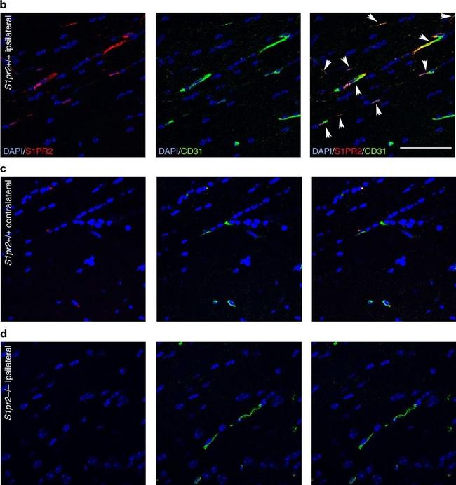 Rabbit IgG (H+L) Highly Cross-Adsorbed Secondary Antibody in Immunohistochemistry (Paraffin) (IHC (P))