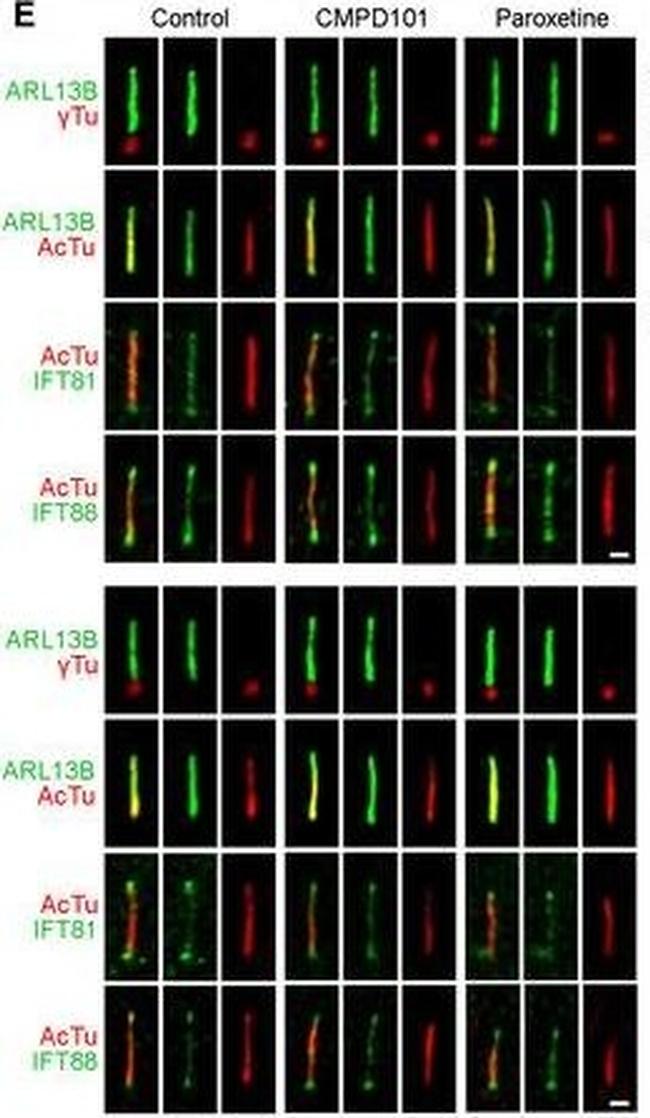 Goat IgG (H+L) Cross-Adsorbed Secondary Antibody in Immunohistochemistry (IHC)