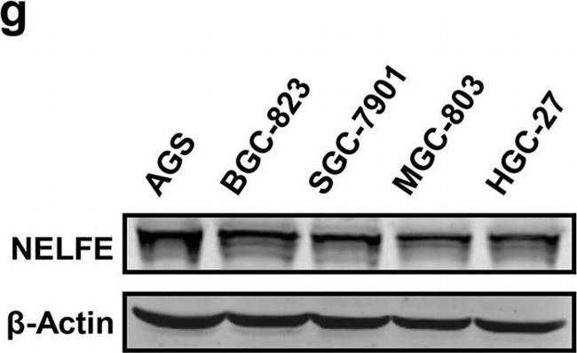 Mouse IgG (H+L) Secondary Antibody in Western Blot (WB)