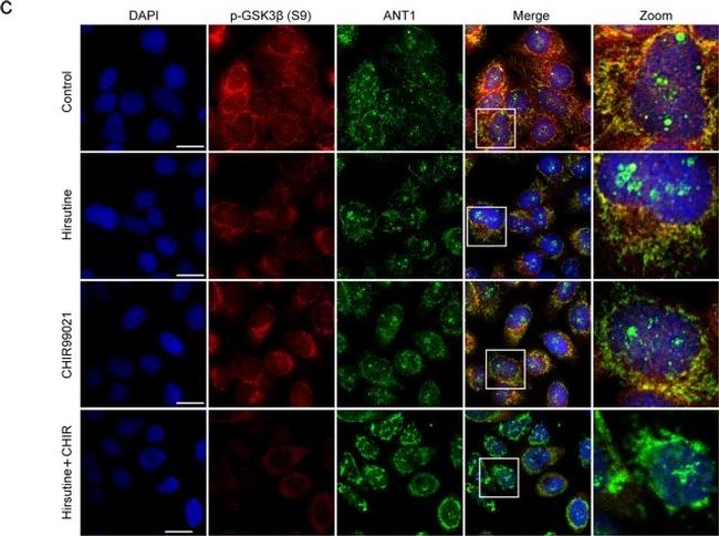 Rabbit IgG (H+L) Highly Cross-Adsorbed Secondary Antibody in Immunocytochemistry (ICC/IF)