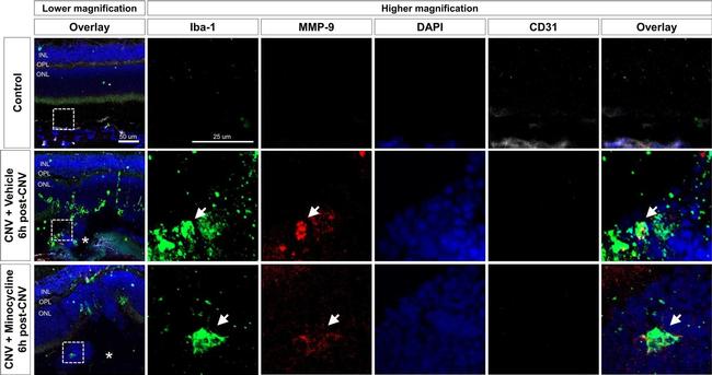 Goat IgG (H+L) Cross-Adsorbed Secondary Antibody in Immunohistochemistry (IHC)