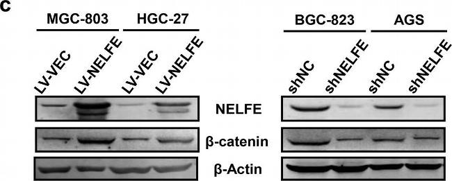 Mouse IgG (H+L) Secondary Antibody in Western Blot (WB)