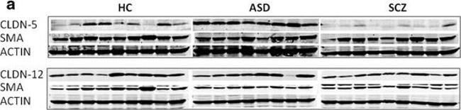 Mouse IgG (H+L) Cross-Adsorbed Secondary Antibody in Western Blot (WB)