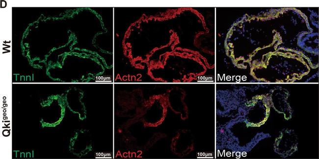 Mouse IgG (H+L) Highly Cross-Adsorbed Secondary Antibody in Immunohistochemistry (IHC)