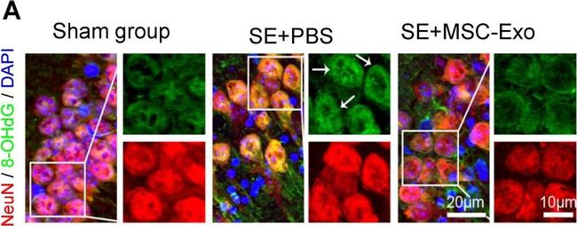 Rabbit IgG (H+L) Highly Cross-Adsorbed Secondary Antibody in Immunohistochemistry (IHC)