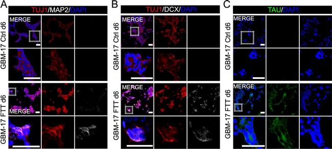 Goat IgG (H+L) Cross-Adsorbed Secondary Antibody in Immunocytochemistry (ICC/IF)