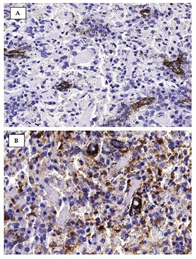 MIF Antibody in Immunohistochemistry (IHC)