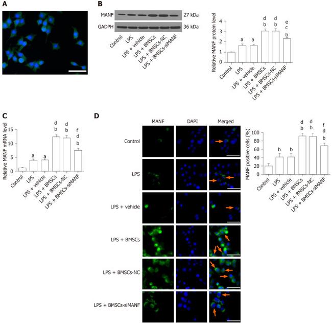 ARMET Antibody in Western Blot, Immunocytochemistry (WB, ICC/IF)