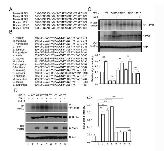 Phospho-HIPK2 (Tyr361) Antibody in Western Blot (WB)