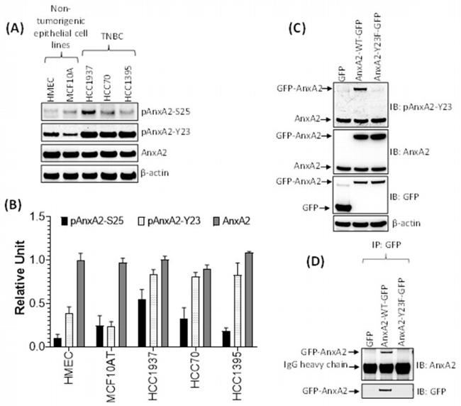 Phospho-Annexin A2 (Ser26) Antibody in Western Blot (WB)