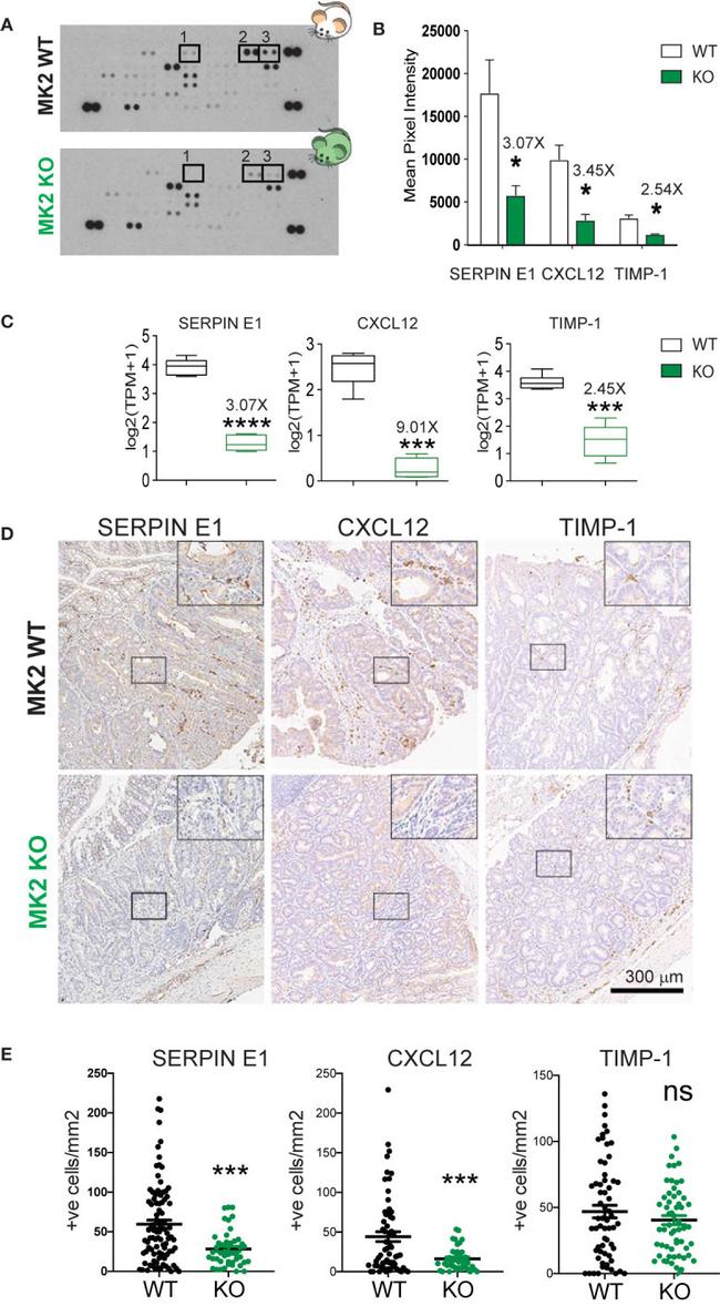 TIMP1 Antibody in Immunohistochemistry (IHC)