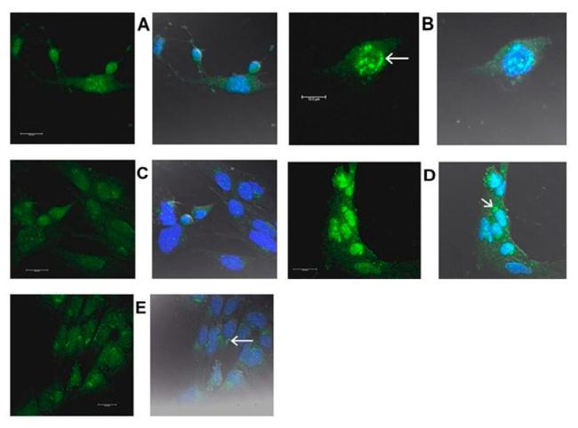 HERPUD1 Antibody in Immunocytochemistry (ICC/IF)