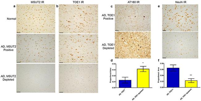 TOE1 Antibody in Immunohistochemistry (IHC)