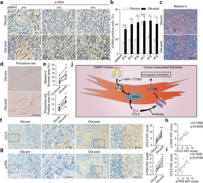 CCL5 (RANTES) Antibody in Immunohistochemistry (IHC)