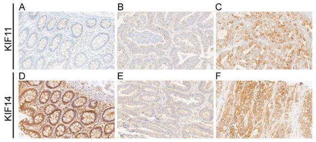 KIF11 Antibody in Immunohistochemistry (IHC)