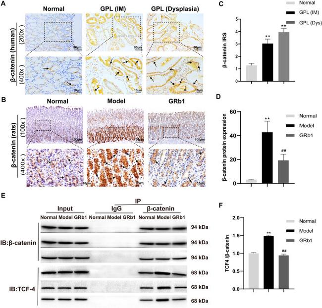 beta Catenin Antibody in Immunohistochemistry (IHC)