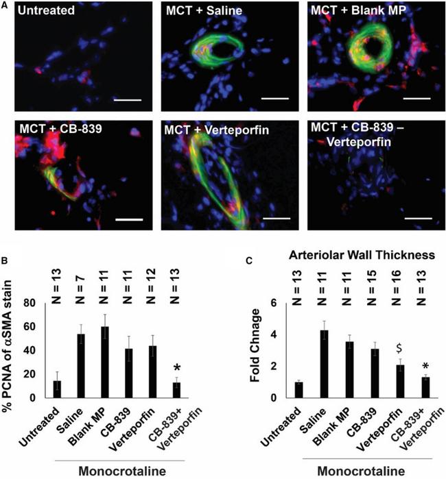 PCNA Antibody in Immunohistochemistry (IHC)