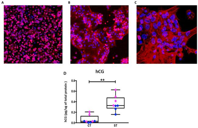 Cytokeratin 7 Antibody in Immunocytochemistry (ICC/IF)