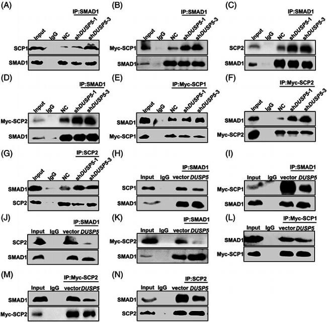 SP2 Antibody in Western Blot, Immunoprecipitation (WB, IP)