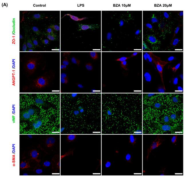 ZO-1 Antibody in Immunocytochemistry (ICC/IF)