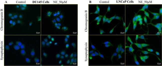 Synaptophysin Antibody in Immunocytochemistry (ICC/IF)