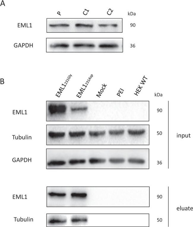 EML1 Antibody in Western Blot, Immunoprecipitation (WB, IP)