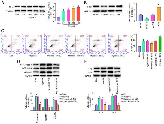 GSDMD Antibody in Western Blot (WB)