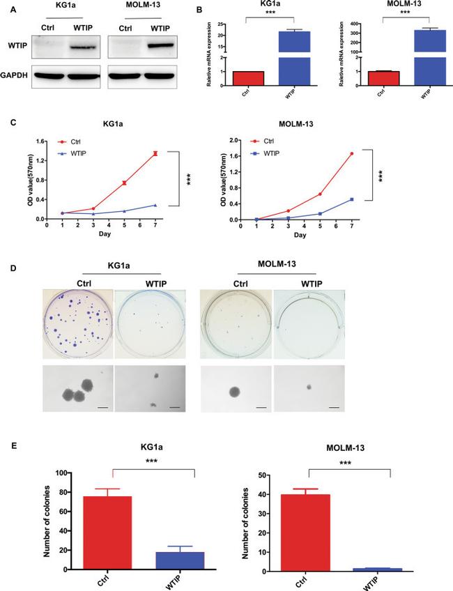 WTIP Antibody in Western Blot (WB)