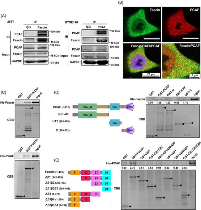 Fascin Antibody in Immunoprecipitation (IP)