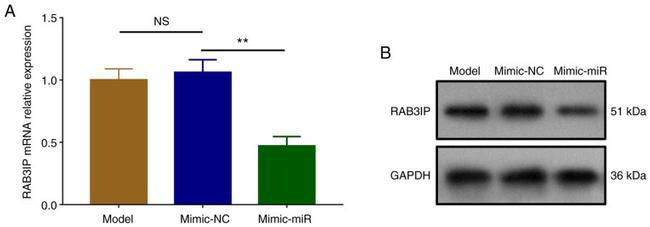 RAB3IP Antibody in Western Blot (WB)