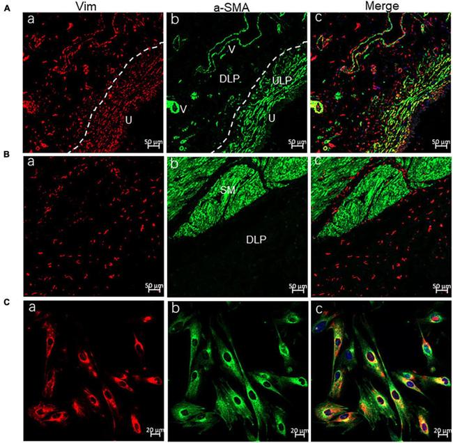 Vimentin Antibody in Immunohistochemistry (IHC)