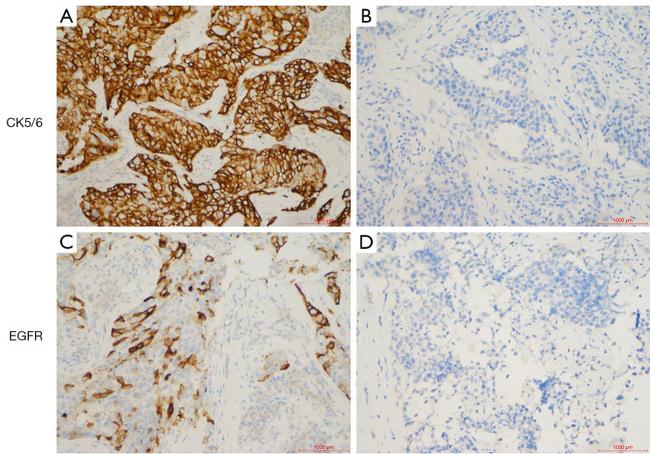 EGFR Antibody in Immunohistochemistry (IHC)