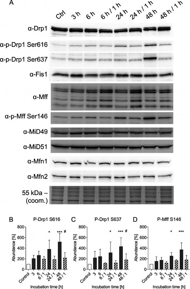 FIS1 Antibody in Western Blot (WB)