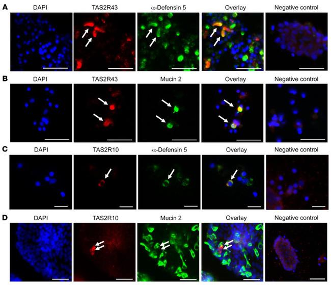 TAS2R43 Antibody in Immunohistochemistry (Frozen) (IHC (F))