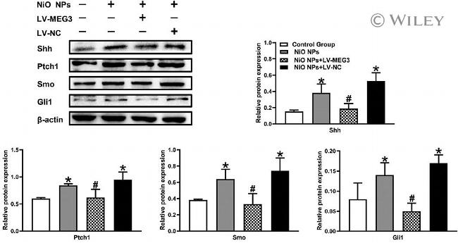 SMO Antibody in Western Blot (WB)