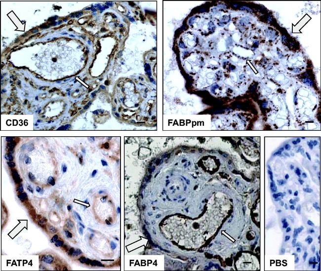 CD36 Antibody in Immunohistochemistry (IHC)