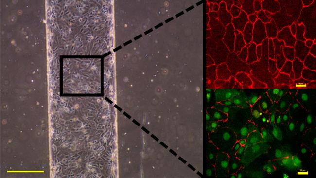 GLUT1 Antibody in Immunocytochemistry (ICC/IF)